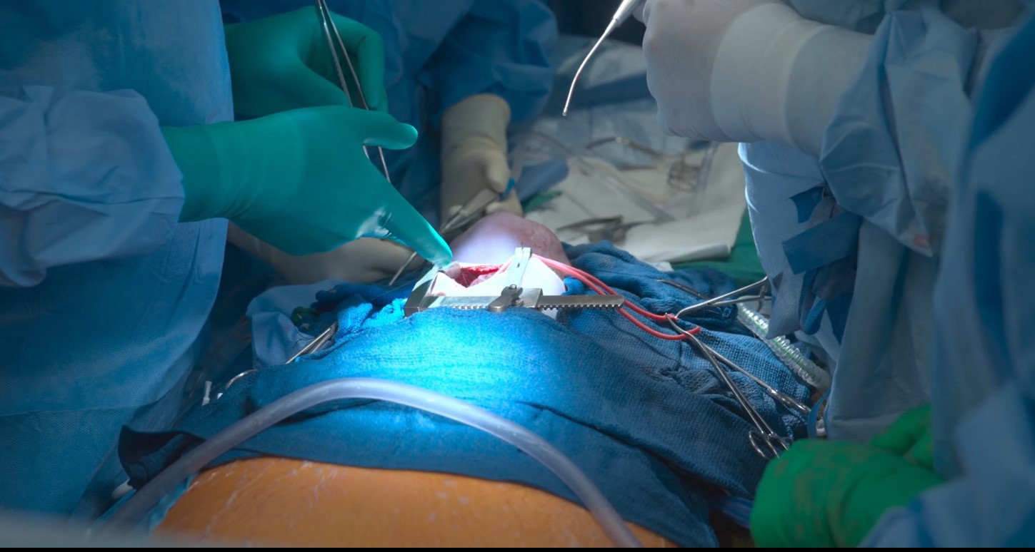 newborn-heart-surgery-2.jpg
