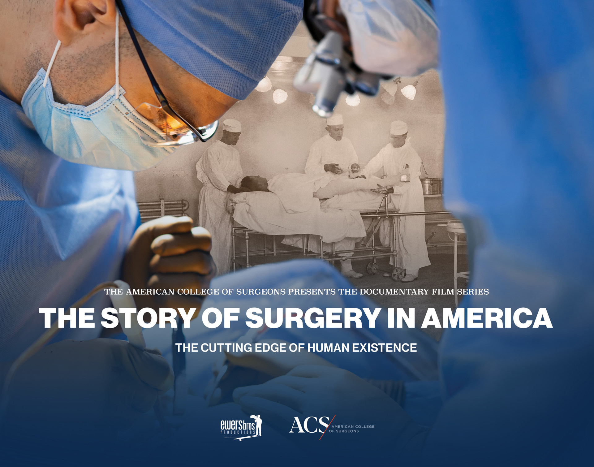 The Story of American Surgery Film Project