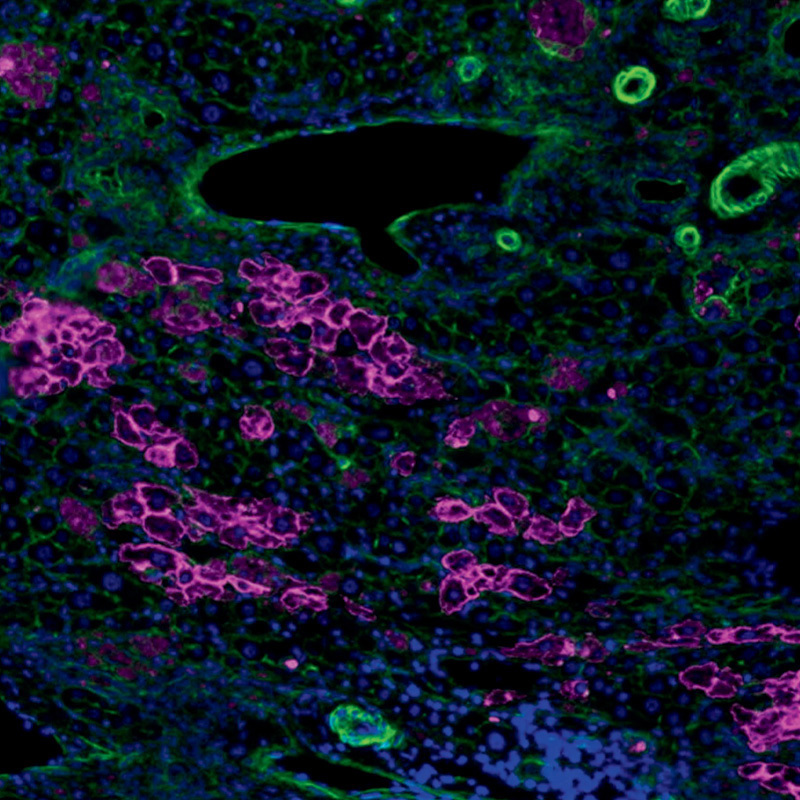 Could Microgravity Help Solve the Liver Transplant Shortage?